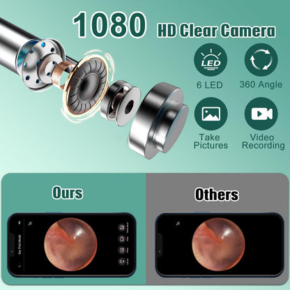 LMECHN wireless otoscope 1080P HD clear camera with 6 LED lights, 360-degree angle, and app view comparison